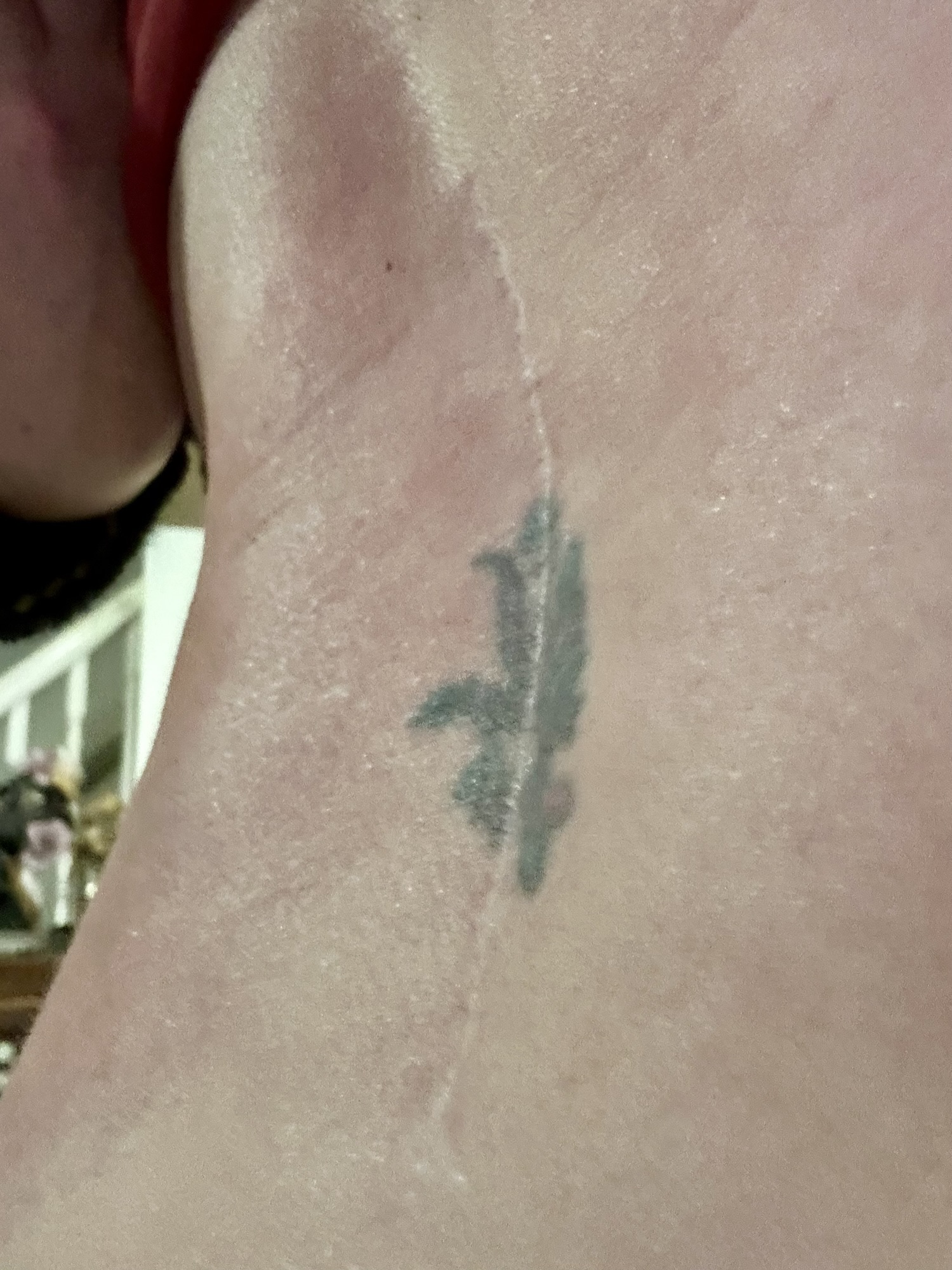 Unseen, Unheard, Unbreakable: The Truth About Chronic&nbsp;Pain