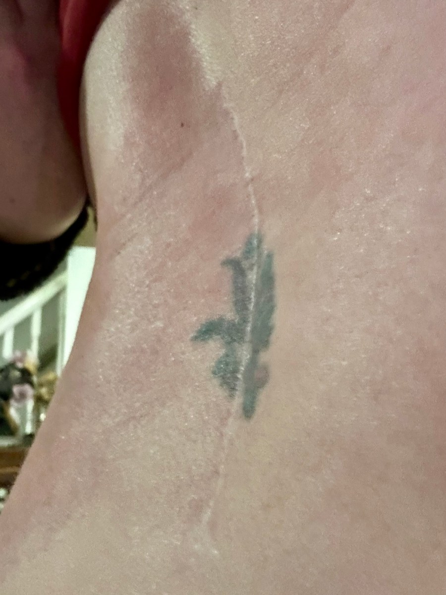 Unseen, Unheard, Unbreakable: The Truth About Chronic&nbsp;Pain